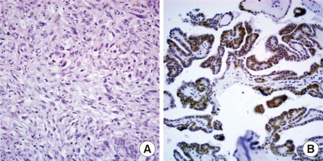 kjpathol-46-55-g003.jpg