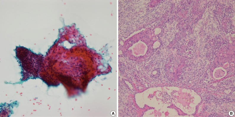 kjpathol-46-569-g001.jpg