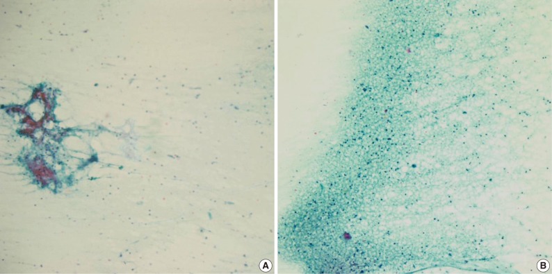 kjpathol-46-569-g002.jpg