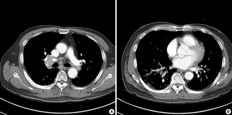 kjpathol-46-583-g001.jpg