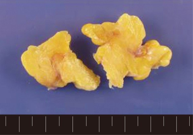 kjpathol-46-587-g001.jpg