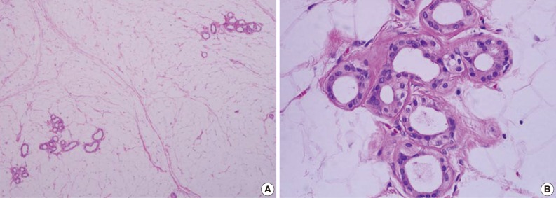 kjpathol-46-587-g002.jpg