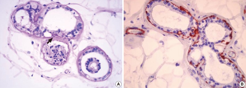 kjpathol-46-587-g003.jpg