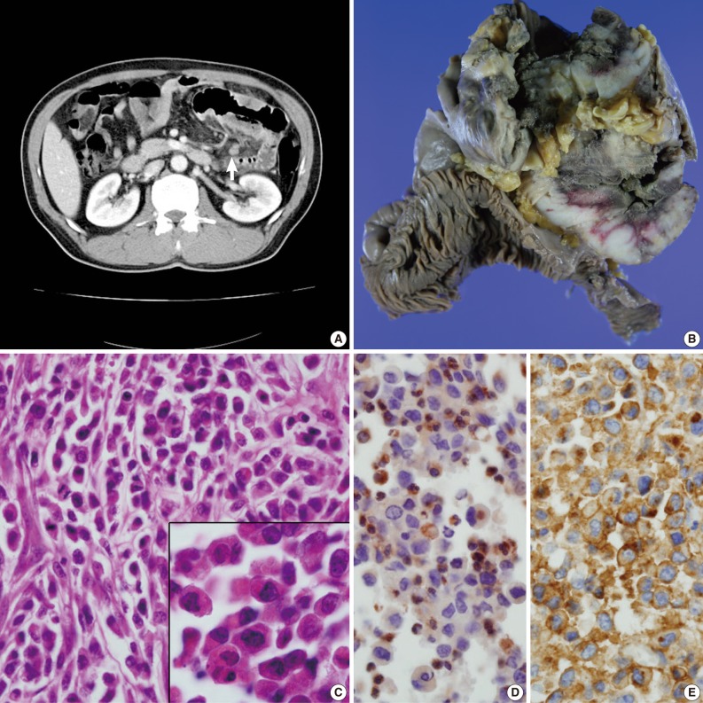 kjpathol-46-590-g001.jpg