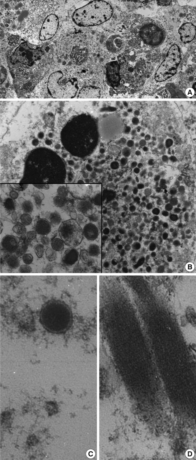 kjpathol-46-590-g002.jpg