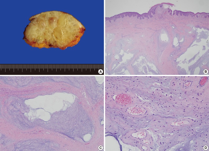 kjpathol-46-595-g004.jpg