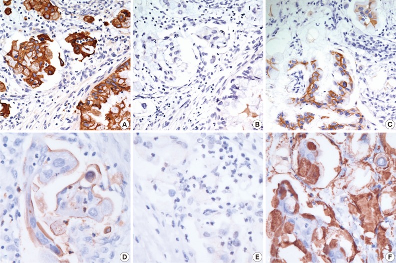 kjpathol-46-611-g003.jpg