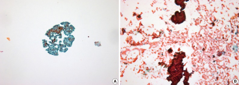 kjpathol-46-68-g002.jpg
