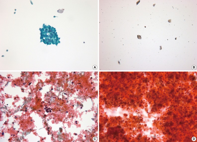 kjpathol-46-68-g004.jpg