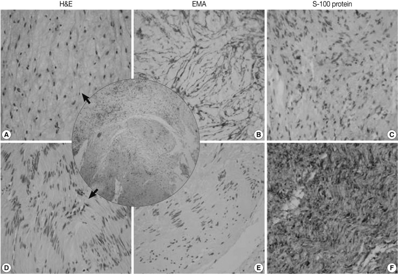 kjpathol-46-75-g002.jpg