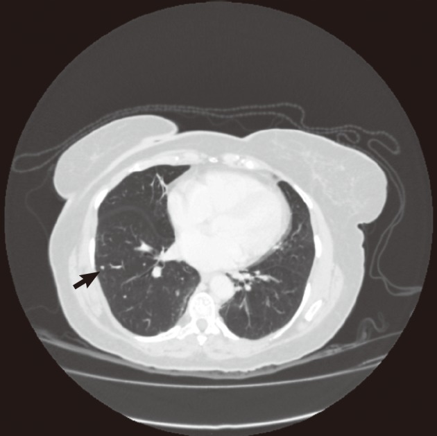 kjpathol-46-87-g001.jpg