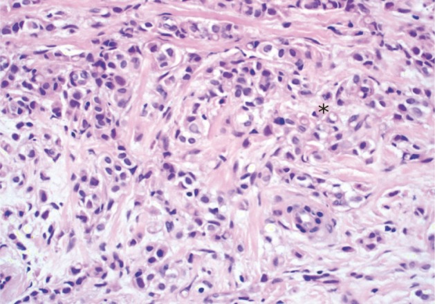 kjpathol-46-87-g003.jpg