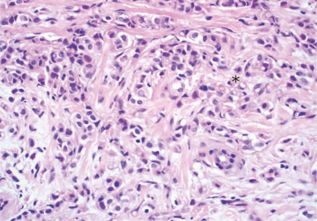 kjpathol-46-87-g003.jpg