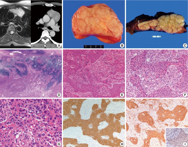 kjpathol-46-92-g001.jpg