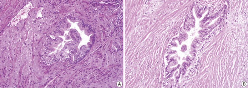 kjpathol-46-96-g003.jpg