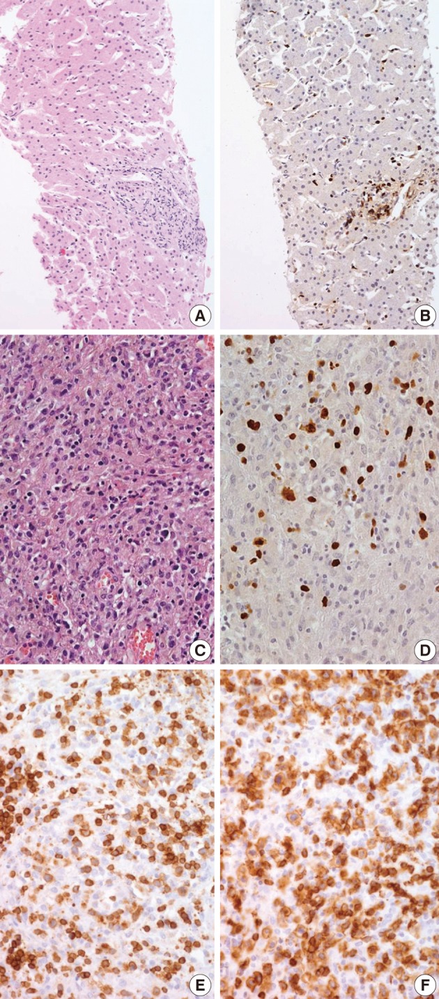 kjpathol-47-137-g003.jpg