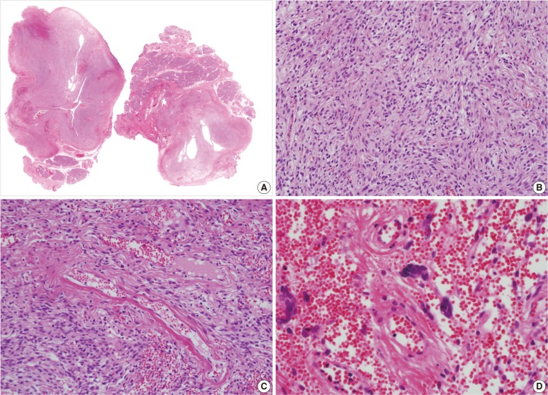 kjpathol-47-158-g002.jpg