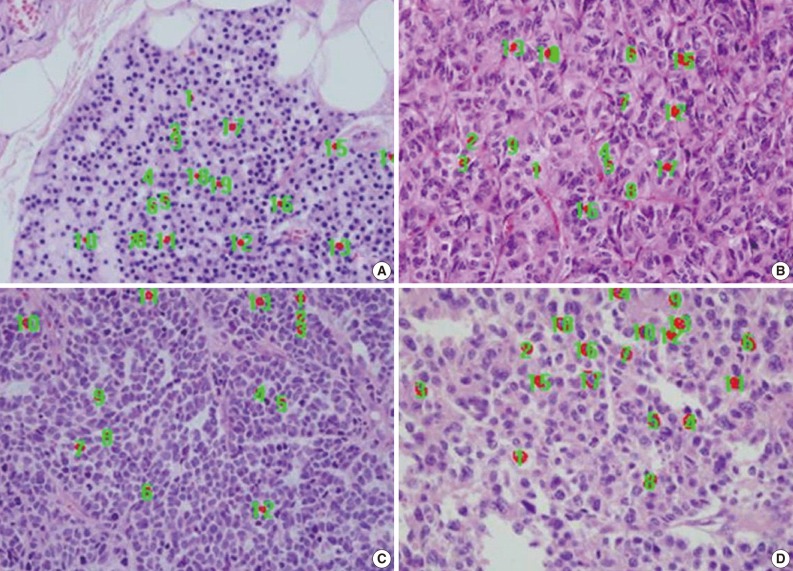 kjpathol-47-16-g001.jpg