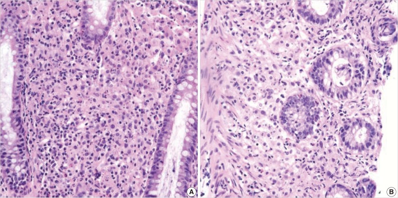 kjpathol-47-163-g002.jpg