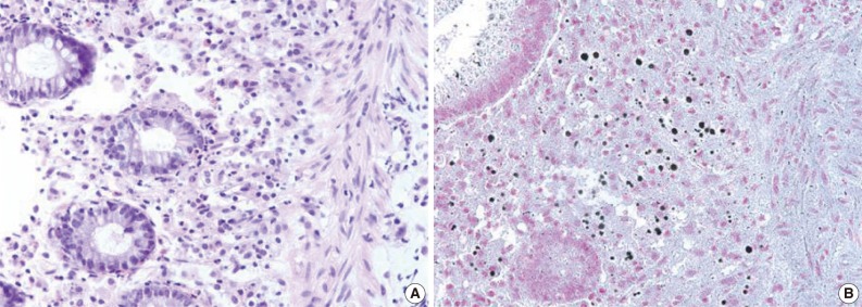 kjpathol-47-163-g003.jpg