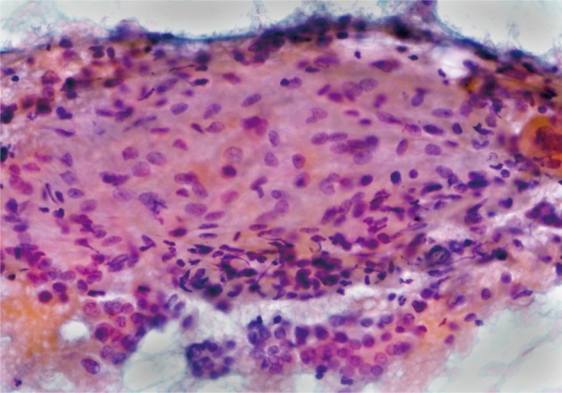 kjpathol-47-167-g002.jpg