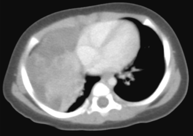 kjpathol-47-172-g001.jpg