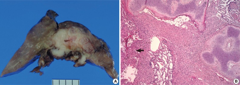 kjpathol-47-172-g002.jpg