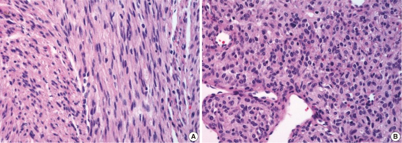 kjpathol-47-172-g003.jpg