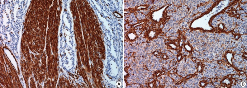 kjpathol-47-172-g004.jpg