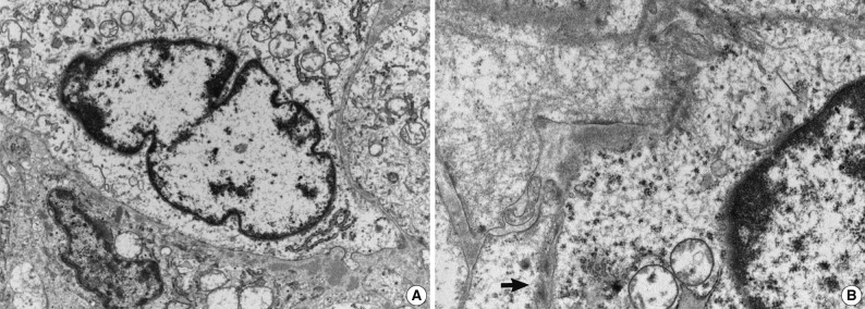 kjpathol-47-172-g005.jpg