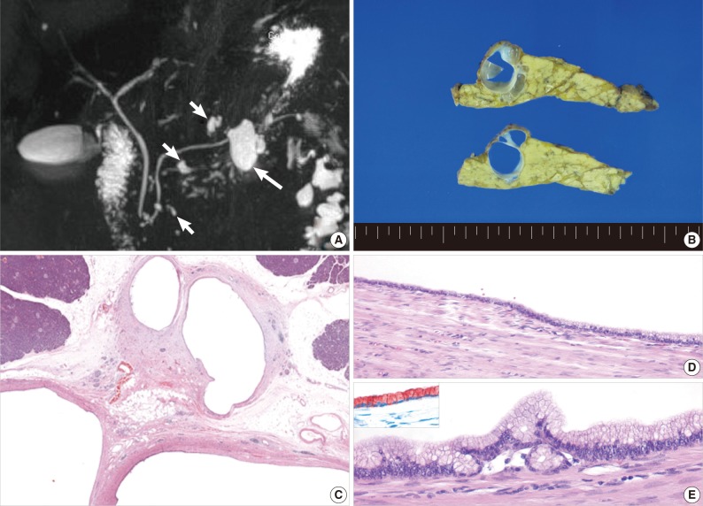 kjpathol-47-188-g001.jpg