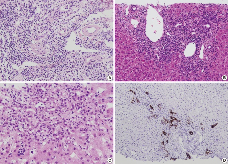 kjpathol-47-21-g005.jpg