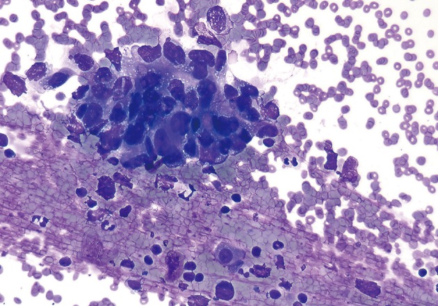 kjpathol-47-258-g002.jpg
