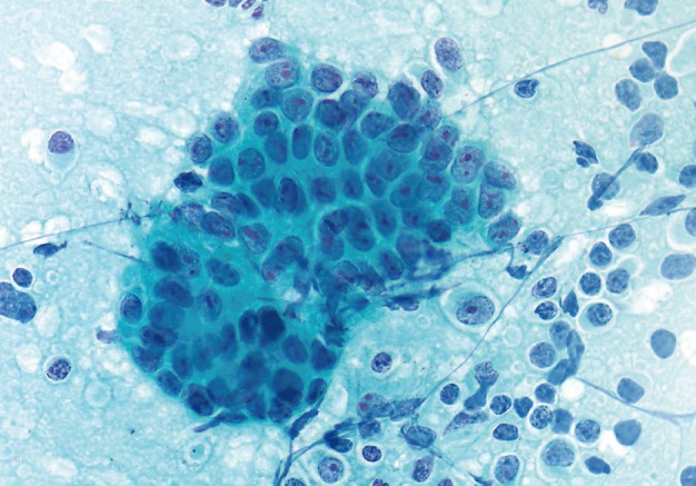 kjpathol-47-258-g003.jpg