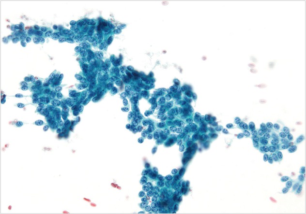 kjpathol-47-258-g004.jpg