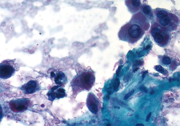 kjpathol-47-258-g005.jpg