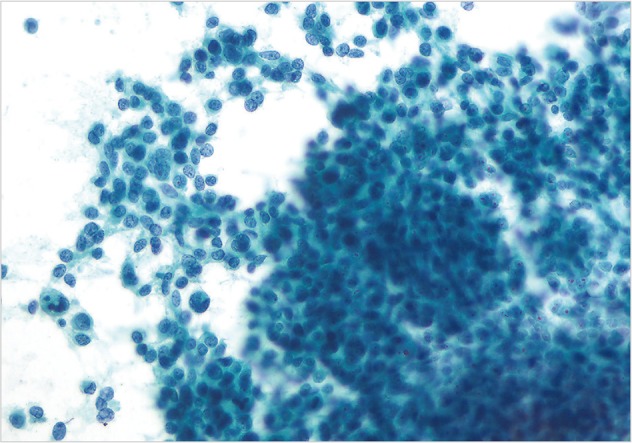 kjpathol-47-258-g006.jpg