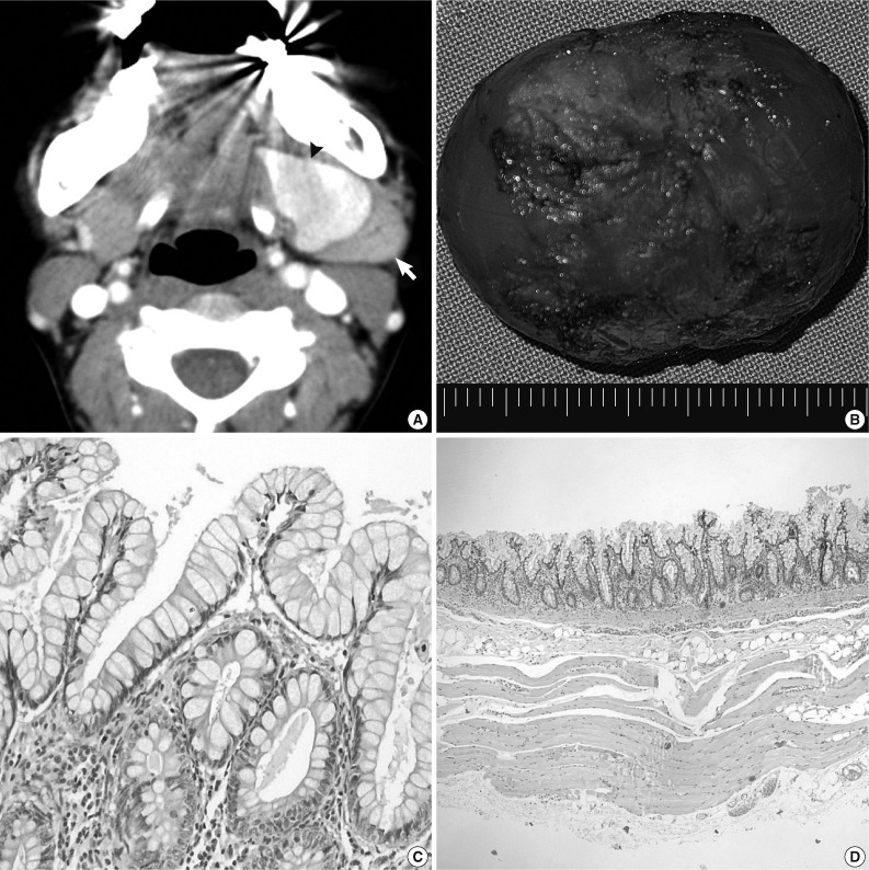 kjpathol-47-279-g001.jpg