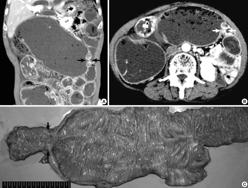 kjpathol-47-289-g001.jpg