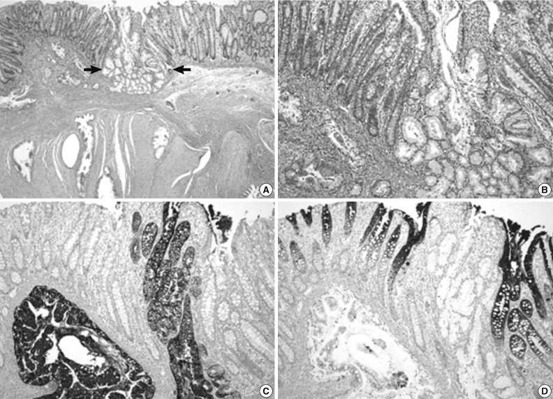 kjpathol-47-289-g002.jpg