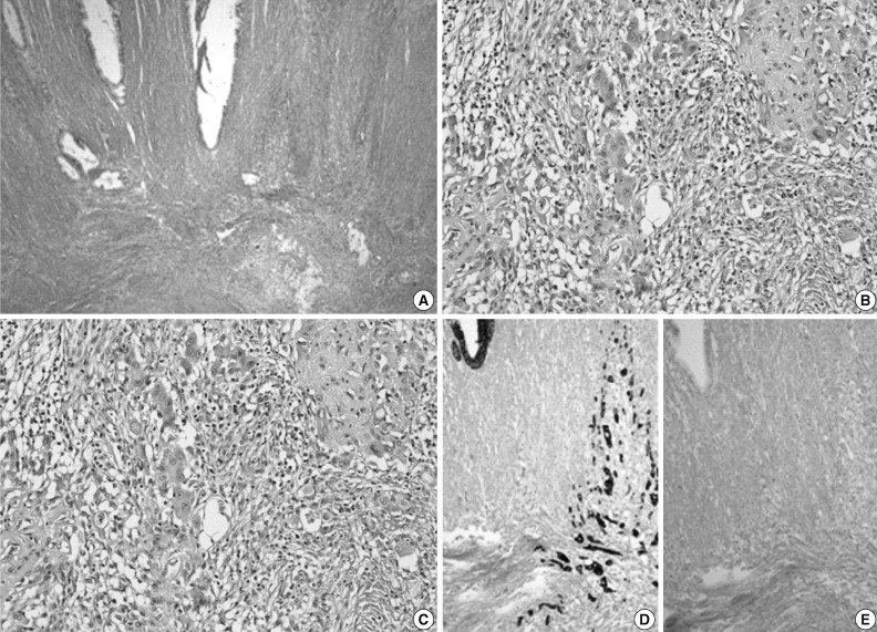 kjpathol-47-289-g003.jpg