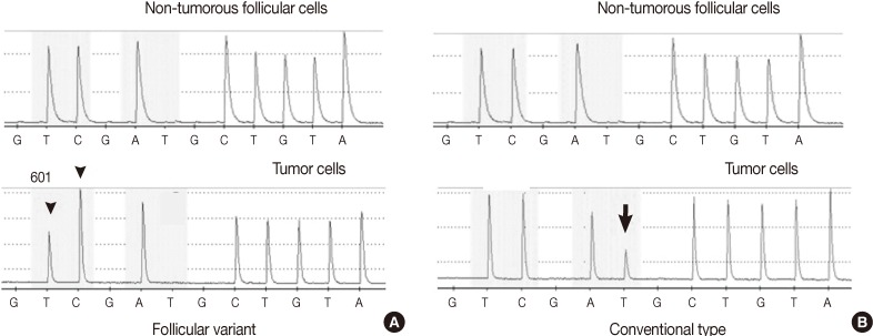 kjpathol-47-293-g003.jpg