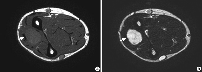 kjpathol-47-299-g001.jpg