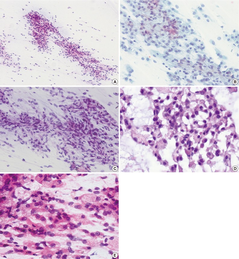 kjpathol-47-299-g002.jpg