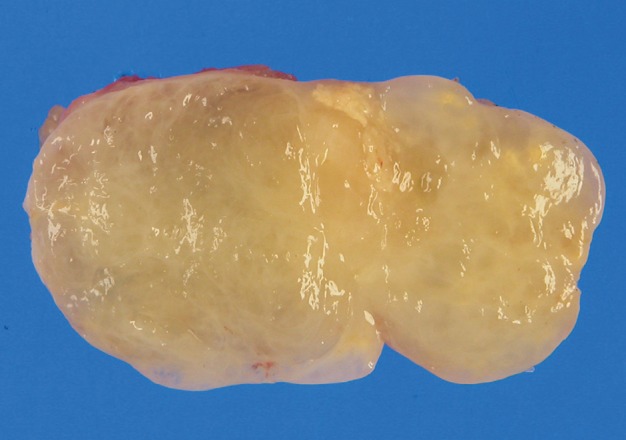 kjpathol-47-299-g003.jpg
