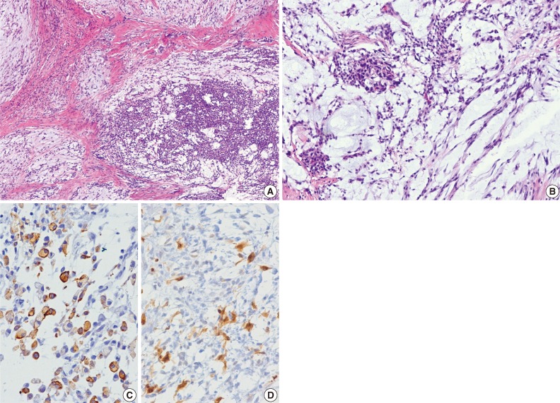 kjpathol-47-299-g004.jpg