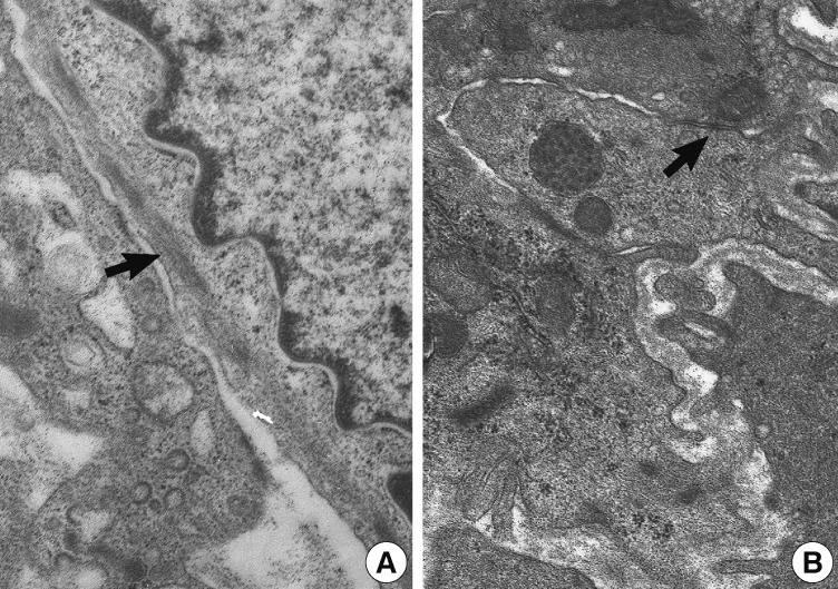 kjpathol-47-299-g005.jpg