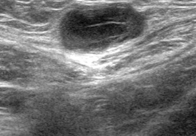 kjpathol-47-304-g001.jpg