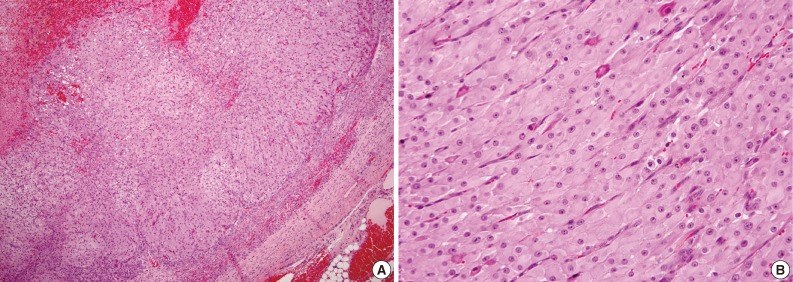 kjpathol-47-304-g002.jpg