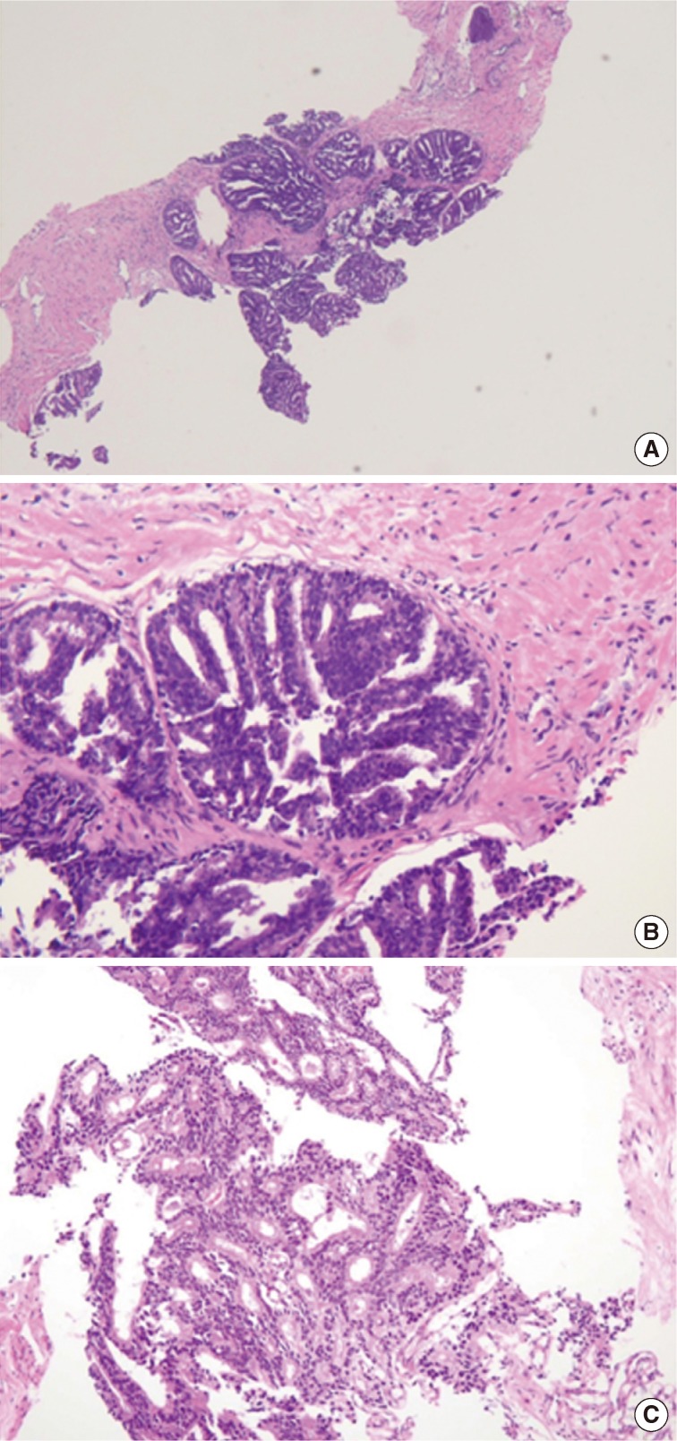 kjpathol-47-307-g001.jpg